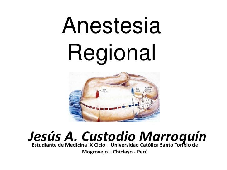 Anestesia Regional - 