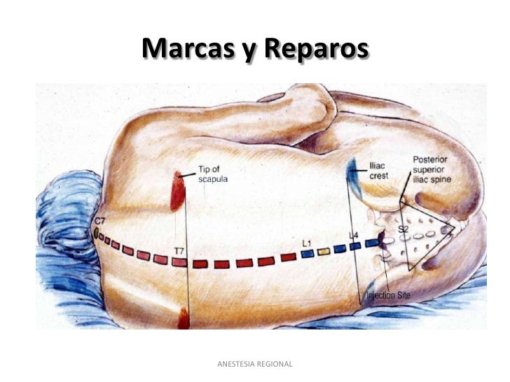 Tecnica debajo de la falda 4