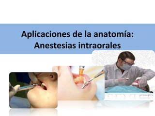 Aplicaciones de la anatomía:
   Anestesias intraorales
 