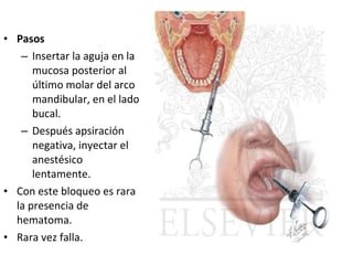 • Pasos
   – Insertar la aguja en la
      mucosa posterior al
      último molar del arco
      mandibular, en el lado
      bucal.
   – Después apsiración
      negativa, inyectar el
      anestésico
      lentamente.
• Con este bloqueo es rara
  la presencia de
  hematoma.
• Rara vez falla.
 