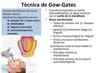 Tècnica de Gow-Gates
Variante del bloqueo del nervio      • Cuando la inyección se realiza
alveolar inferior.                     adecuadamente, la aguja contacta
Anestesia los siguientes nervios:      con el cuello de la mandíbula.
    N. alveolar inf. y ramos term.   • Áreas anestesiadas
    N. milohioideo                      – Todos los dientes md (n. alveolar
    N. lingual (a menudo)                 inferior)
    N. auriculotemporal (a              – Epitelio 2/3 anteriores lengua (n.
    menudo)                               lingual)
                                        – Encía y mucosa lingual (n. lingual)
                                        – Encía y mucosas vestibulares,
                                          desde los
                                        premolares hasta la línea media (n.
                                          mentoniano)
                                        – Piel labio inferior (n.
                                          mentoniano)
                                        – Piel zona anterior de la oreja (n.
                                          auriculotemporal)
 