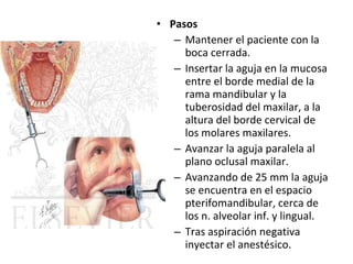• Pasos
   – Mantener el paciente con la
     boca cerrada.
   – Insertar la aguja en la mucosa
     entre el borde medial de la
     rama mandibular y la
     tuberosidad del maxilar, a la
     altura del borde cervical de
     los molares maxilares.
   – Avanzar la aguja paralela al
     plano oclusal maxilar.
   – Avanzando de 25 mm la aguja
     se encuentra en el espacio
     pterifomandibular, cerca de
     los n. alveolar inf. y lingual.
   – Tras aspiración negativa
     inyectar el anestésico.
 