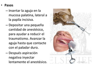 • Pasos
   – Insertar la aguja en la
     mucosa palatina, lateral a
     la papila incisiva.
   – Depositar una pequeña
     cantidad de anestésico,
     para ayudar a reducir el
     traumatismo. Avanzar la
     aguja hasta que contacte
     con el paladar duro.
   – Después aspiración
     negativa inyectar
     lentamente el anestésico.
 