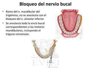 Bloqueo del nervio bucal
• Ramo del n. mandibular del
  trigémino, no se anestesia con el
  bloqueo del n. alveolar inferior
• Se anestesia toda la encía bucal
  correspondientes a los molares
  mandibulares, incluyendo el
  trígono retromolar.
 