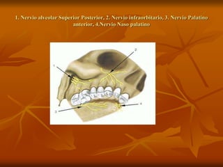 1. Nervio alveolar Superior Posterior, 2. Nervio infraorbitario, 3. Nervio Palatino
anterior, 4.Nervio Naso palatino
 