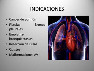 INDICACIONES
• Cáncer de pulmón
• Fistulas        Bronco
  pleurales.
• Empiema-
  bronquiectasias
• Resección de Bulas
• Quistes
• Malformaciones AV
 