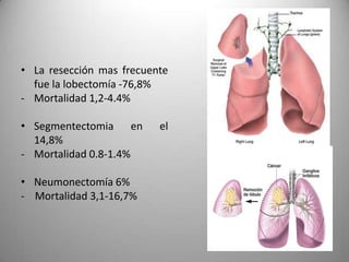 • La resección mas frecuente
  fue la lobectomía -76,8%
- Mortalidad 1,2-4.4%

• Segmentectomia en       el
  14,8%
- Mortalidad 0.8-1.4%

• Neumonectomía 6%
- Mortalidad 3,1-16,7%
 