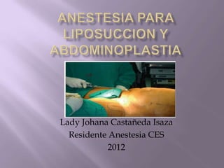 Lady Johana Castañeda Isaza
  Residente Anestesia CES
            2012
 