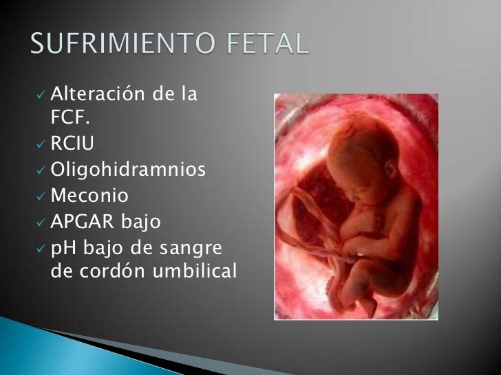 MECONIO Y SUFRIMIENTO FETAL EPUB DOWNLOAD MECONIO Y SUFRIMIENTO FETAL EPUB DOWNLOAD