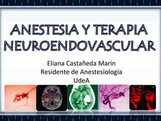 Eliana Castañeda Marín
Residente de Anestesiología
           UdeA
 