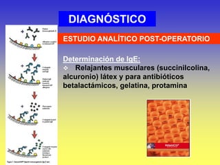 DIAGNÓSTICO
ESTUDIO ANALÍTICO POST-OPERATORIO
Determinación de IgE:
 Relajantes musculares (succinilcolina,
alcuronio) látex y para antibióticos
betalactámicos, gelatina, protamina
 