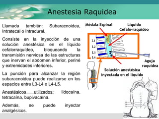 ETAPAS DEL PROCESO DE LA APLICACION DE ANESTESICOS PPTX
