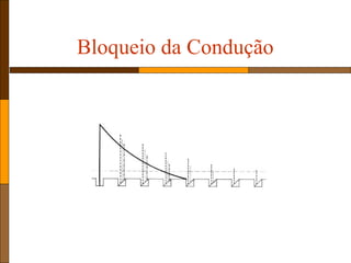 Bloqueio da Condução
 