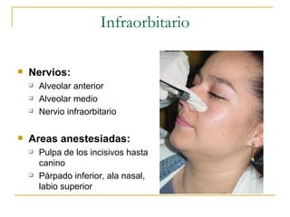 Infraorbitario Nervios: Alveolar anterior Alveolar medio Nervio infraorbitario Areas anestesiadas: Pulpa de los incisivos hasta canino Párpado inferior, ala nasal, labio superior 