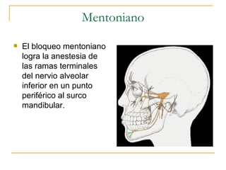 Mentoniano El bloqueo mentoniano logra la anestesia de las ramas terminales del nervio alveolar inferior en un punto periférico al surco mandibular. 