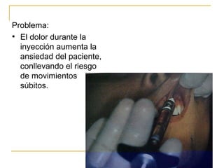 Problema: El dolor durante la inyección aumenta la ansiedad del paciente, conllevando el riesgo de movimientos súbitos. 