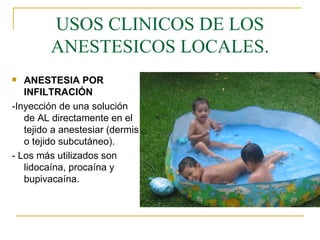 USOS CLINICOS DE LOS ANESTESICOS LOCALES. ANESTESIA POR INFILTRACIÓN -Inyección de una solución de AL directamente en el tejido a anestesiar (dermis o tejido subcutáneo). - Los más utilizados son lidocaína, procaína y bupivacaína. 