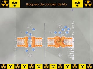 Bloqueo de canales de Na NBM + 