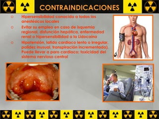 CONTRAINDICACIONES Hipersensibilidad conocida a todos los anestésicos locales  Evitar su empleo en caso de isquemia regional, disfunción hepática, enfermedad renal o hipersensibilidad a la Lidocaína  Hipotensión, latido cardiaco lento o irregular, palidez inusual, transpiración incrementada). Puede llevar a paro cardiaco; toxicidad del sistema nervioso central   