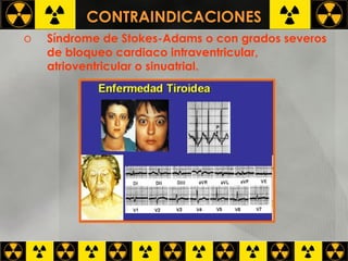 CONTRAINDICACIONES Síndrome de Stokes-Adams o con grados severos de bloqueo cardiaco intraventricular, atrioventricular o sinuatrial.  