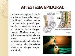 AANNEESSTTEESSIIAA EEPPIIDDUURRAALL 
La anestesia epidural suele 
emplearse durante la cirugía, 
combinada muchas veces 
con anestesia general, por 
su efecto protector frente a 
la respuesta de estrés por 
cirugía. Muchas veces se 
utiliza cuando es esencial un 
buen control 
postoperatorio del dolor (p. 
ej., cirugía del aneurisma 
aórtico o cirugía mayor 
intestinal). 
 