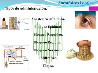 Anestésicos Locales
Tipos de Administración.
Anestésica Oftálmica.
Bloqueo Epidural.
Bloqueo Raquídeo.
Bloqueo Regional.
Bloqueo Nervioso.
Infiltrativo.
Tópica.
 