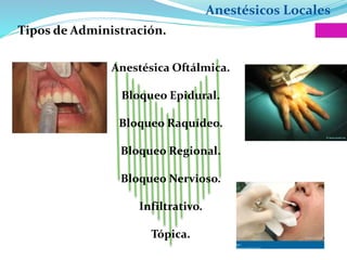 Anestésicos Locales
Tipos de Administración.
Anestésica Oftálmica.
Bloqueo Epidural.
Bloqueo Raquídeo.
Bloqueo Regional.
Bloqueo Nervioso.
Infiltrativo.
Tópica.
 