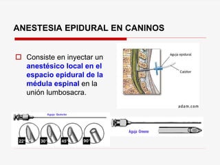 ANESTESIA EPIDURAL EN CANINOS
 Consiste en inyectar un
anestésico local en el
espacio epidural de la
médula espinal en la
unión lumbosacra.
 