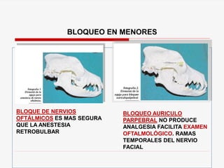 BLOQUEO EN MENORES
BLOQUE DE NERVIOS
OFTÁLMICOS ES MAS SEGURA
QUE LA ANESTESIA
RETROBULBAR
BLOQUEO AURICULO
PARPEBRAL NO PRODUCE
ANALGESIA FACILITA EXAMEN
OFTALMOLÓGICO. RAMAS
TEMPORALES DEL NERVIO
FACIAL
 