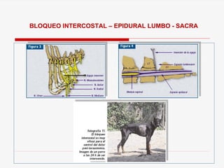 BLOQUEO INTERCOSTAL – EPIDURAL LUMBO - SACRA
 