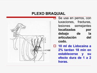 PLEXO BRAQUIAL
 Se usa en perros, con
luxaciones, fracturas,
lesiones semejantes
localizadas por
debajo de la
articulación del
codo.
 10 ml de Lidocaína a
2% tardan 18 min en
establecerse y su
efecto dura de 1 a 2
horas.
 