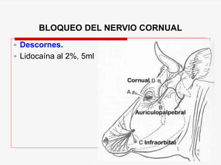 BLOQUEO DEL NERVIO CORNUAL
 Descornes.
 Lidocaína al 2%, 5ml
 