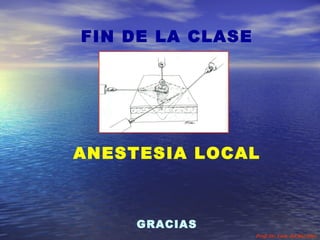 ANESTESICOS LOCALES TIPOS Y TECNICAS. Prfo. Dr. Luis del Rio Diez Slide 42