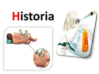Historia
 