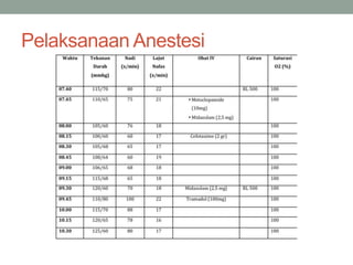 Pelaksanaan Anestesi
 
