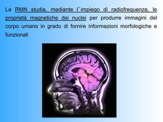 La RMN studia, mediante l’impiego di radiofrequenze, le
proprietà magnetiche dei nuclei per produrre immagini del
corpo umano in grado di fornire informazioni morfologiche e
funzionali
 