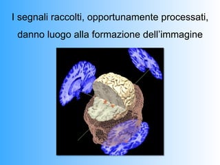 I segnali raccolti, opportunamente processati,
 danno luogo alla formazione dell’immagine
 