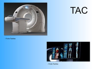 TAC

- Fonte Toshiba




                  - Fonte Toshiba
 