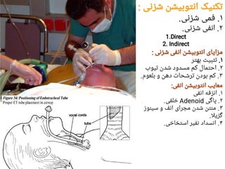 Anesthesia 2.pdf