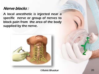 Anesthesia I Types, Stages, Complications - Dr Rohit Bhaskar | PDF