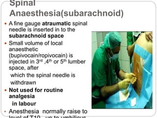 Spinal
Anaesthesia(subarachnoid)
 A fine gauge atraumatic spinal
needle is inserted in to the
subarachnoid space
 Small volume of local
anaesthetic
(bupivocain/ropivocain) is
injected in 3rd ,4th or 5th lumber
space, after
which the spinal needle is
withdrawn
 Not used for routine
analgesia
in labour
• Anesthesia normally raise to
 