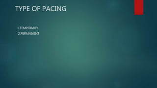 TYPE OF PACING
1.TEMPORARY
2.PERMANENT
 