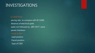 INVESTIGATIONS
12 LEAD ECG:
pacing rate to compare with ID CARD
Absence of electrical spike
spike not followed by QRS OR P wave
paced chambers
CHEST X-RAY
Lead position
Paced position
Type of CIED
 