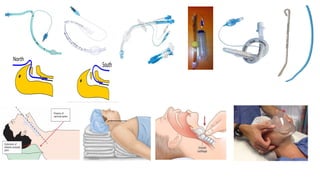 Comprehensive Guide to Anaesthesia: Instruments, Techniques, and ...