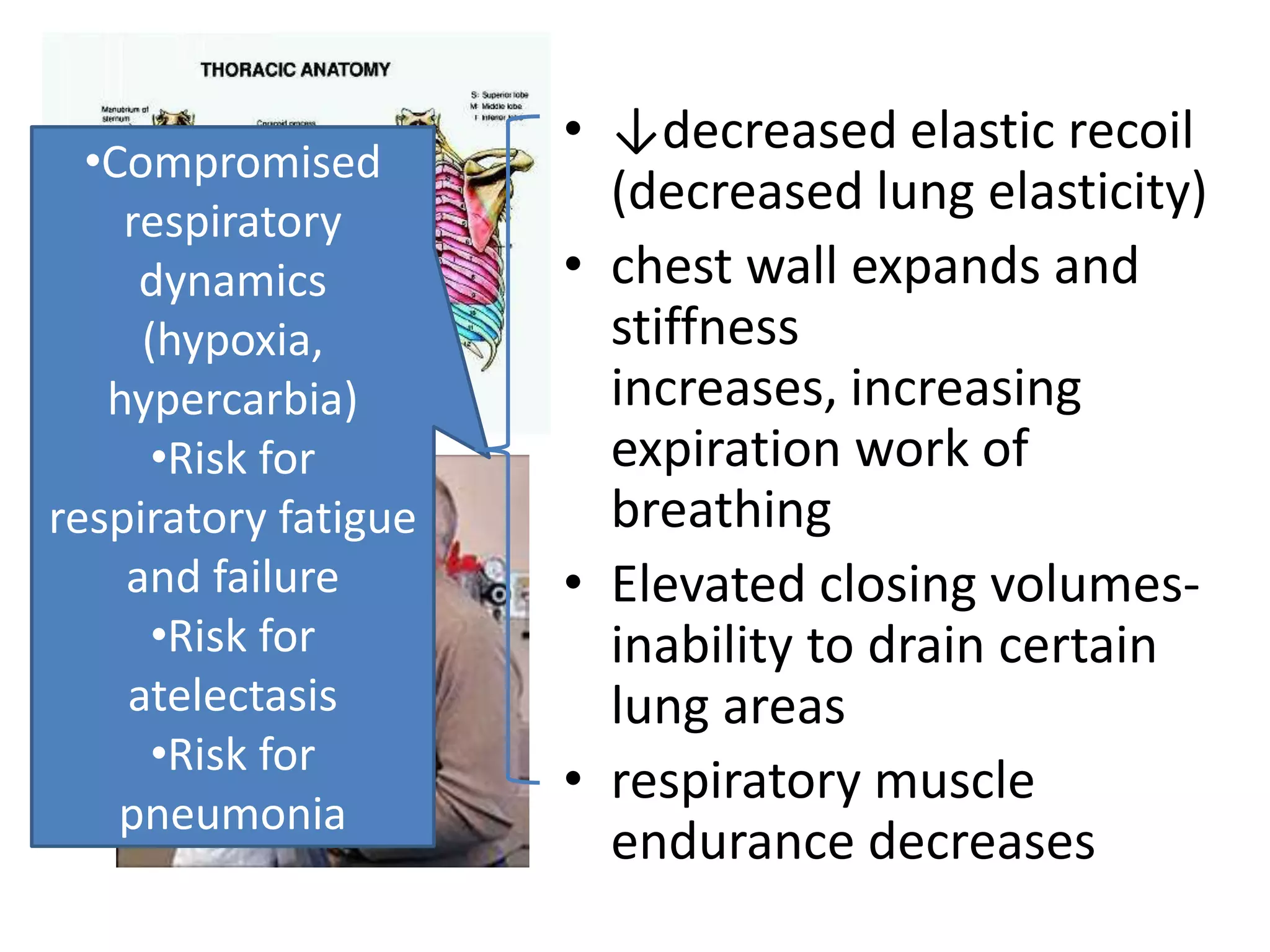• ↓decreased elastic recoil
  •Compromised
    respiratory
                        (decreased lung elasticity)
     dynamics         • chest wall expands and
     (hypoxia,          stiffness
   hypercarbia)         increases, increasing
      •Risk for         expiration work of
respiratory fatigue     breathing
    and failure       • Elevated closing volumes-
      •Risk for         inability to drain certain
    atelectasis         lung areas
      •Risk for
                      • respiratory muscle
    pneumonia
                        endurance decreases
 