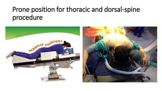 Prone position for thoracic and dorsal-spine
procedure
 