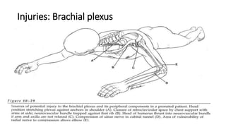 Injuries: Brachial plexus
 