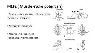 MEPs ( Muscle evoke potentials)
• Motor cortex stimulated by electrical
or magnetic means
• Myogenic responses
• Neurogenic responses:
peripheral N or spinal cord
 