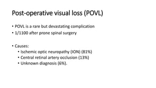 Post-operative visual loss (POVL)
• POVL is a rare but devastating complication
• 1/1100 after prone spinal surgery
• Causes:
• Ischemic optic neuropathy (ION) (81%)
• Central retinal artery occlusion (13%)
• Unknown diagnosis (6%).
 