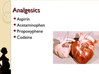 AnalgesicsAnalgesics
Aspirin
Acetaminophen
Propoxyphene
Codeine
 